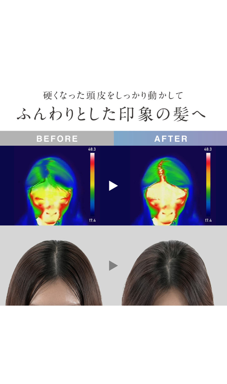 ▼■NIPLUX EMS HEAD SPA PREMIUM【WEB限定】 ブラック 0